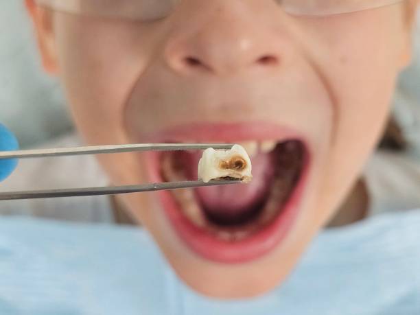 Best Cosmetic Emergency Dentistry in Callaway, FL